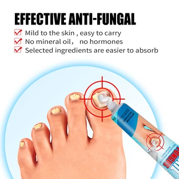 baie împotriva ciupercii unghiilor cum să vindeci ciuperca populară de pe unghiile de la picioare
